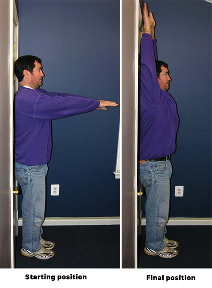 Standing arm exercise for spondylolisthesis
