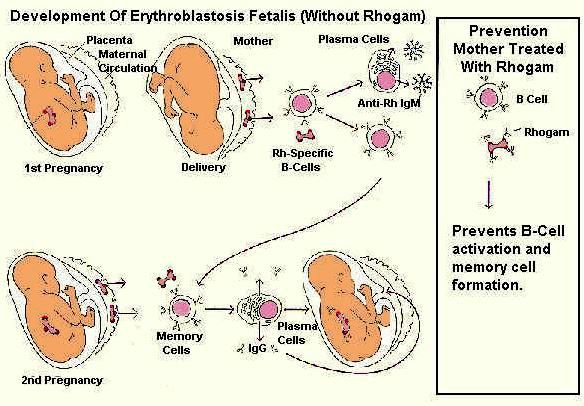 rh incompatibility development erythroblastosis fetalis