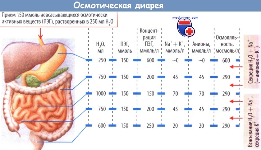 Хологенная диарея. Осмотическая диарея. Осмотическая диарея механизм. Осмотический Тип диареи. Осмотическая диарея причины.