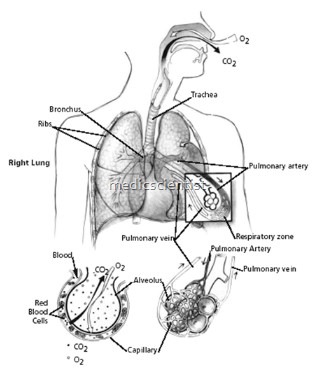 Disorders of Ventilation