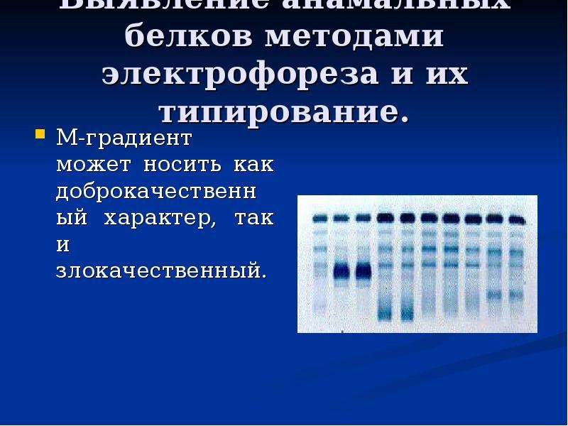 М градиент. М градиент при электрофорезе белков сыворотки крови. Электрофорез белков сыворотки крови при миеломной болезни. Миеломная болезнь электрофорез белков. Зональный электрофорез белков.