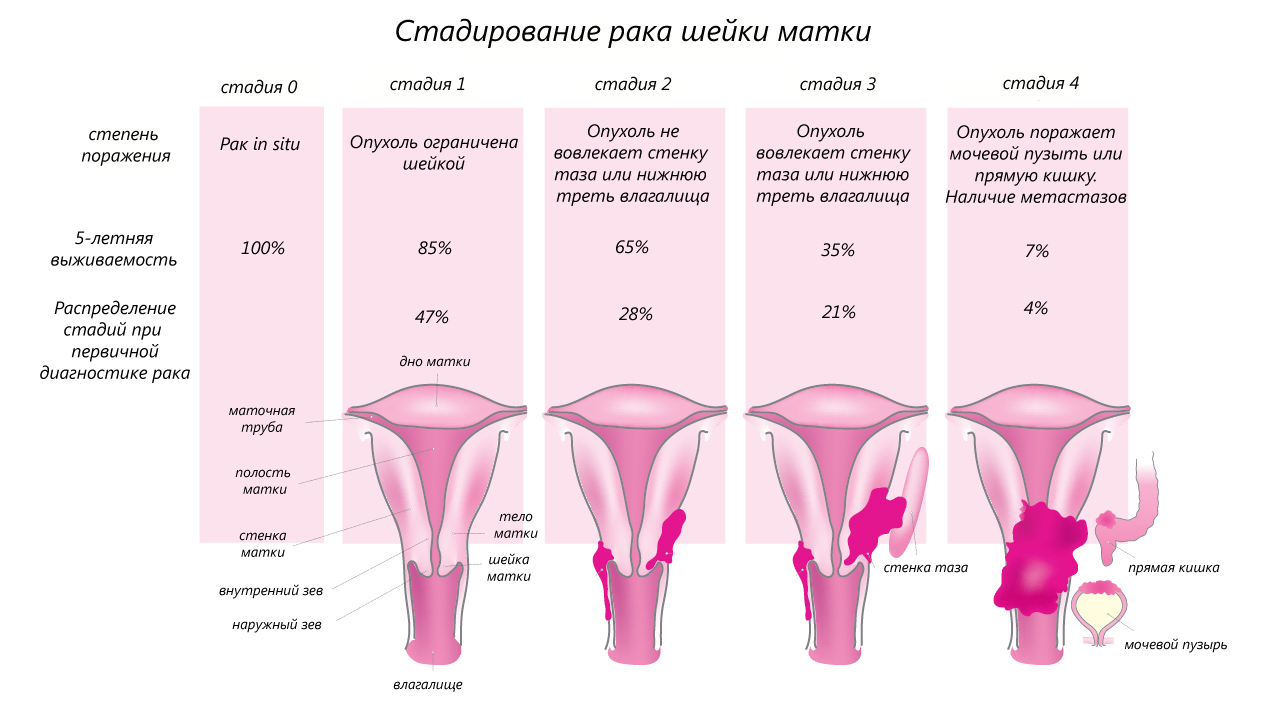 Стадии