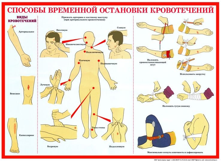 Презентация на тему кровотечение и способы остановки