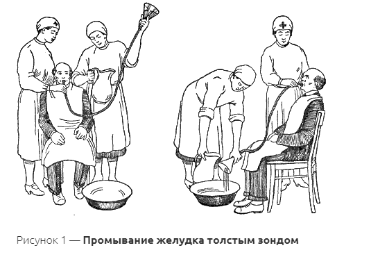 Промывание желудка схема алгоритм