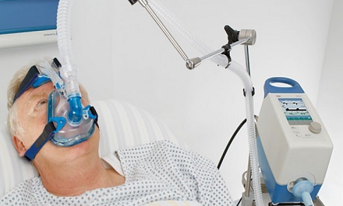 Важность аппарата искусственной вентиляции легких 