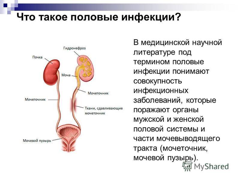 Мочеполовые заболевания. Болезнь мочевыделительной системы у мужчин симптомы. Симптомы болезней мочеполовой системы. Препараты от инфекции мочеполовой системы у мужчин. Инфекционные заболевания мочевыделительной системы.