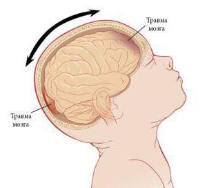 субдуральная гематома последствия