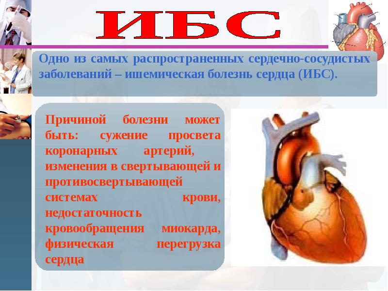 Сердечные заболевания у взрослых. Причины сердечно-сосудистых заболеваний. Ишемическая болезнь сердца.