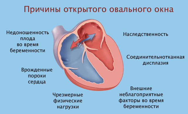 Причины патологии