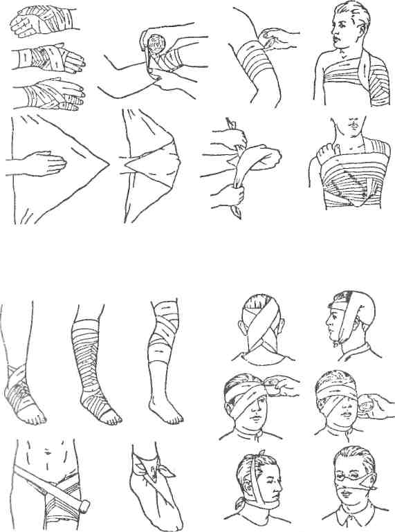 Способы повязки. Типы наложения бинтовых повязок. Техника наложения бинтовых повязок. Повязки десмургия правила наложения повязок. Десмургия классификация повязок.