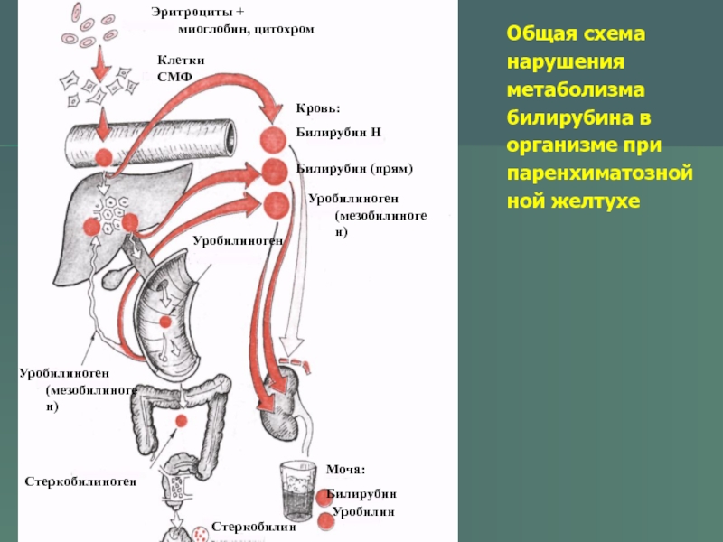 Схема превращения билирубина в кишечнике