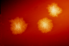 Clostridium difficile на агарі крові