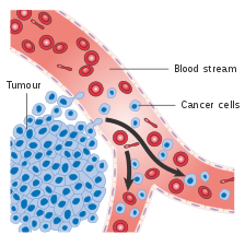 Diagram showing cancer cells spreading into the blood stream CRUK 448.svg