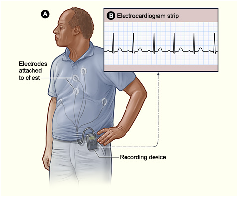 holter