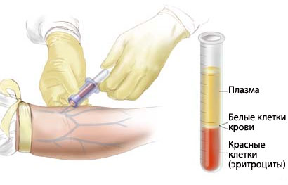Взятие крови