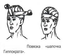 Повязка гиппократа. Шапка Гиппократа показания. Повязка шапочка техника. Горлова повязка шапочка Гиппократа. Перевязка шапочка летчика.