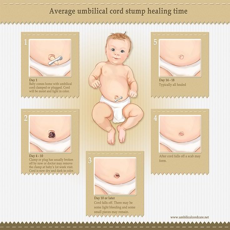 Umbilical Cord Bleeding Care Tips